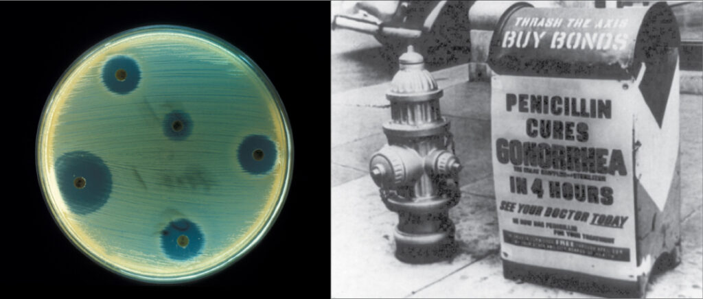 Petri dish showing antibiotic inhibition of bacteria beside a vintage penicillin advertisement.