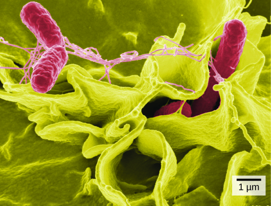 figure_03_03b-2 salmonella SEM